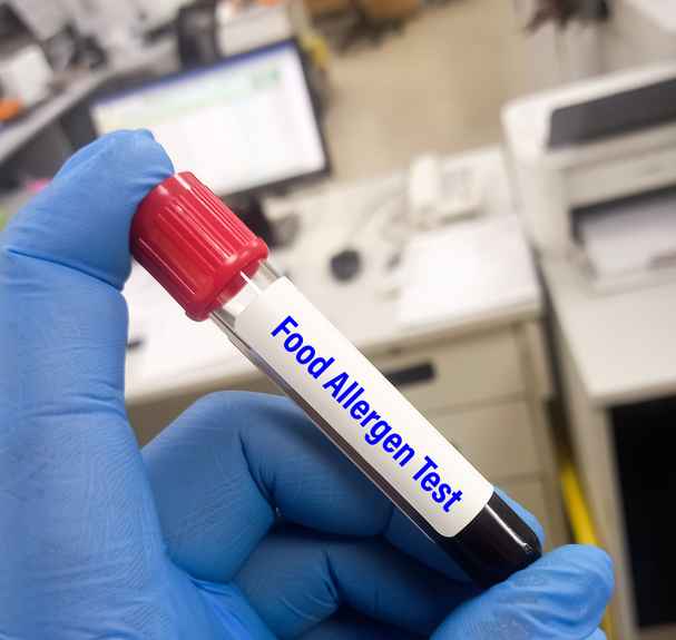 Photo shows hand holding blood sample for food allergen test/Getty images