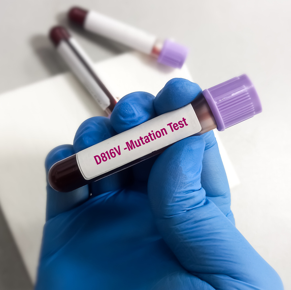 Photo shows blood sample for KIT(D816V) mutation testing/Getty Images