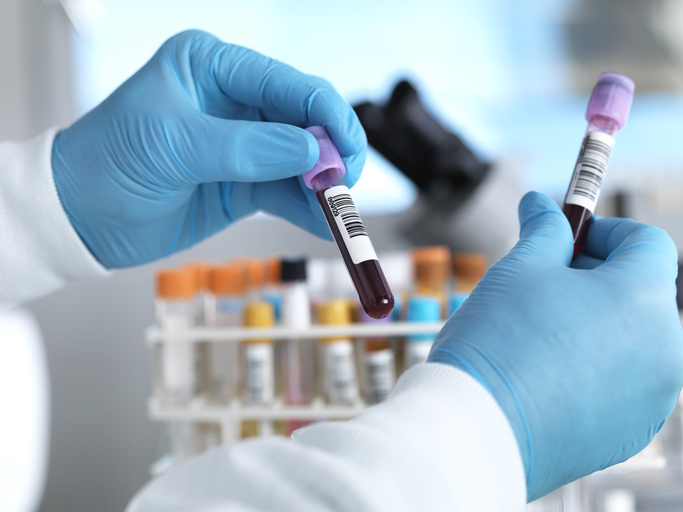 Photo shows hand holding blood sample in laboratory/Getty Images