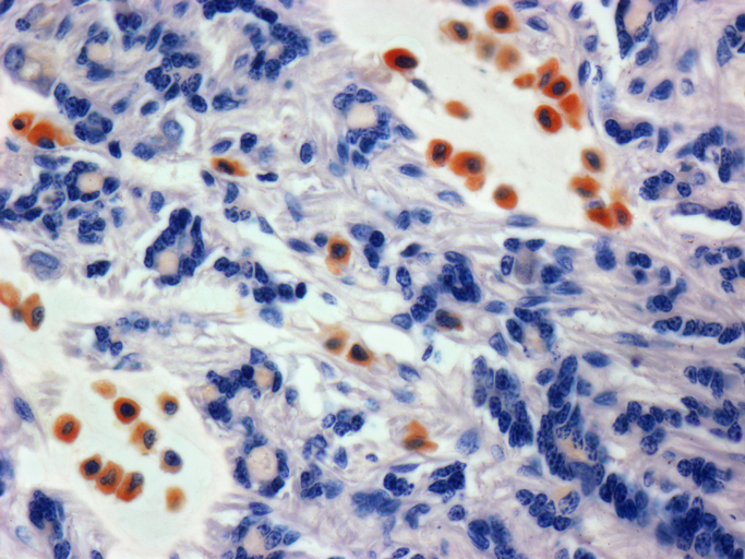 Image shows a light micrograph of a section through the sub mucosa of the trachea (wind pipe) showing mast cells (red).