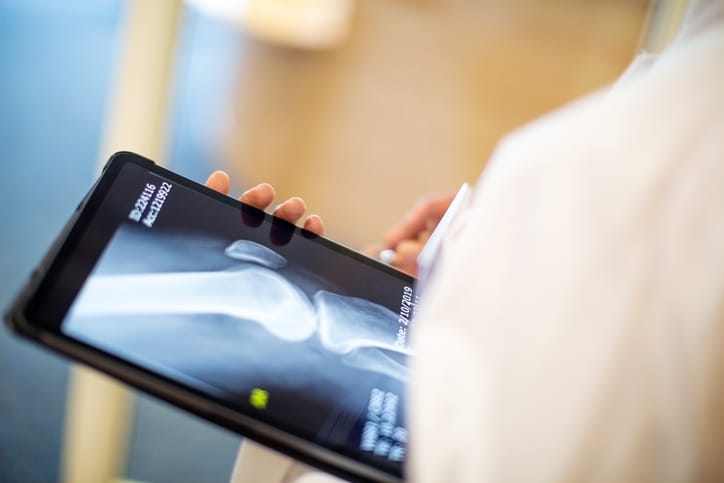 Photo shows a medical professional looking at x-ray image of a patient/Getty Images