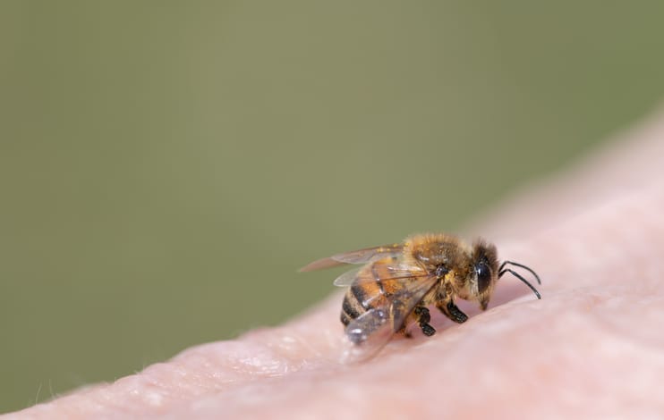 Photo shows honey bee on human skin