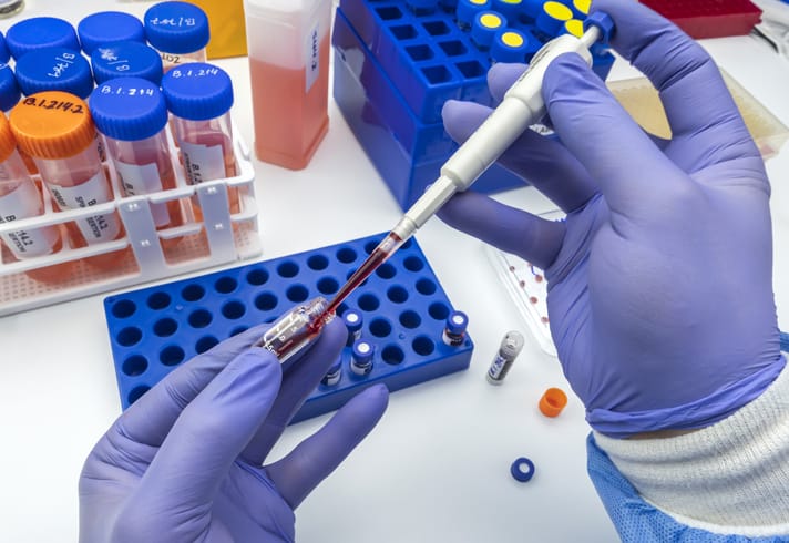 Photo shows blood analysis