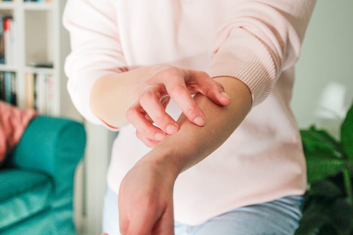 Photo show woman scratching arm