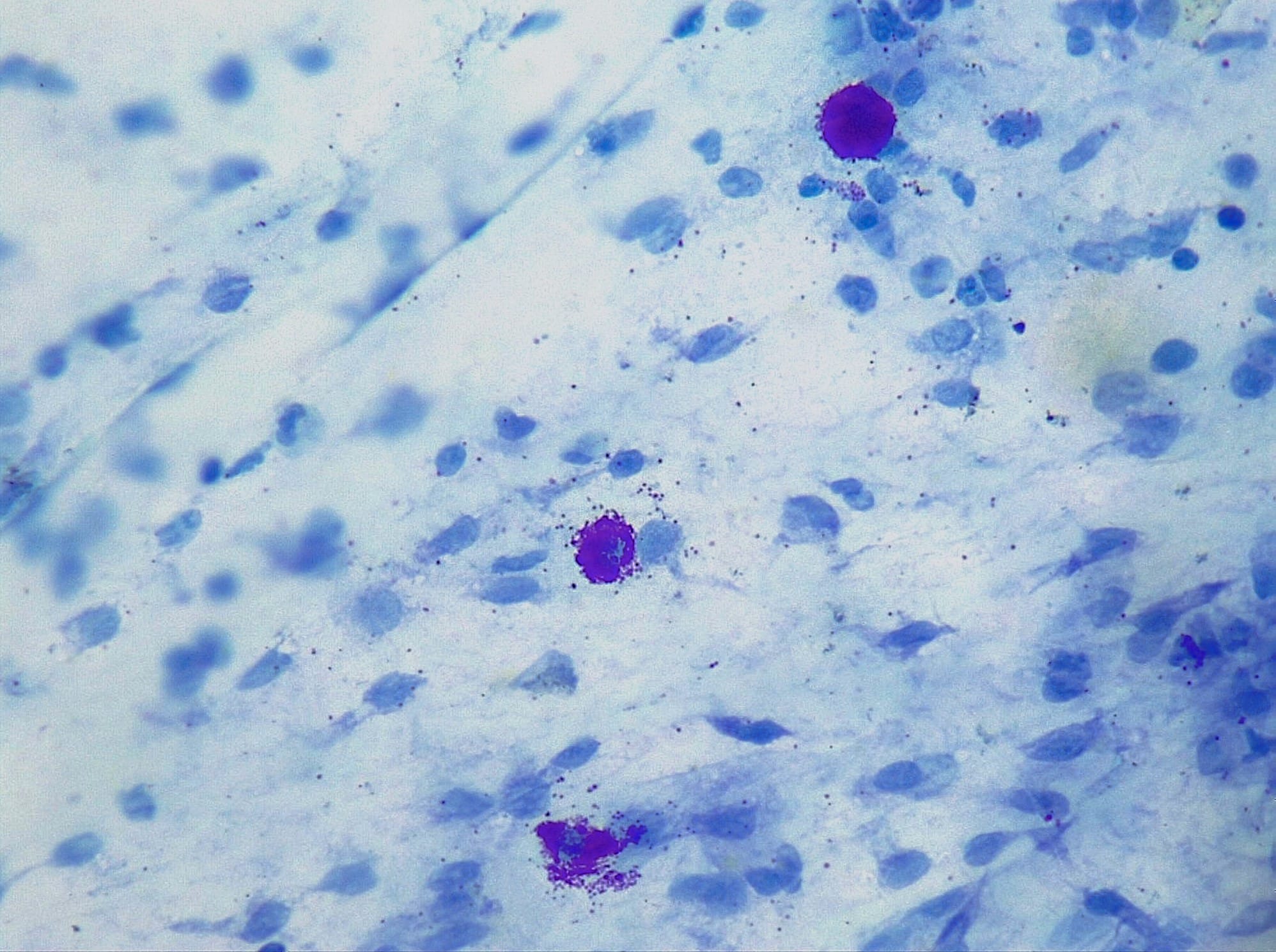 Mast cells