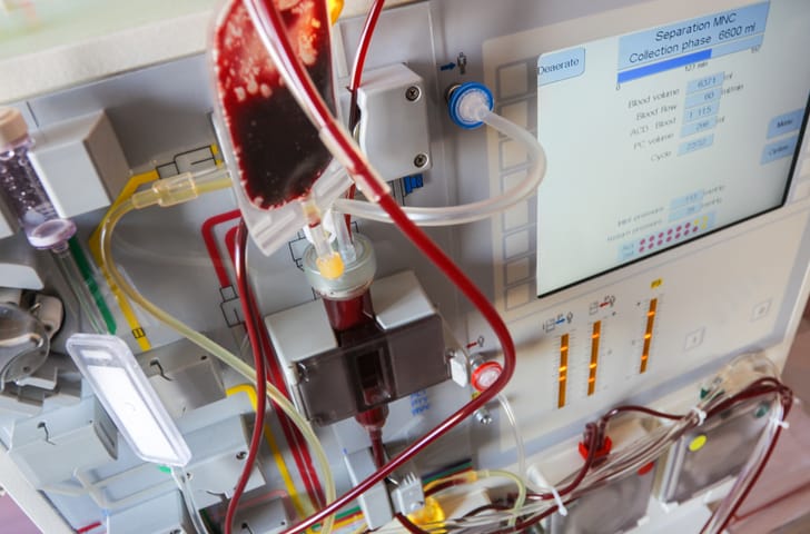 Blood transfusion medical equipment, used in hospital to treat illness with stem cells.