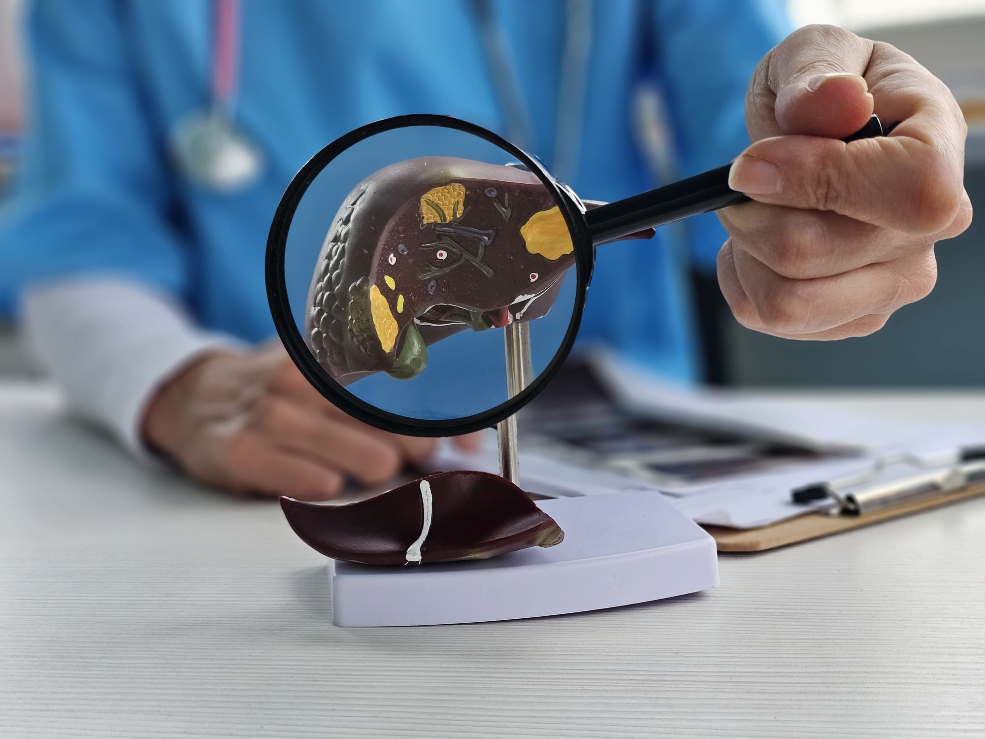 Doctor holding magnifying glass in front of a model of the liver