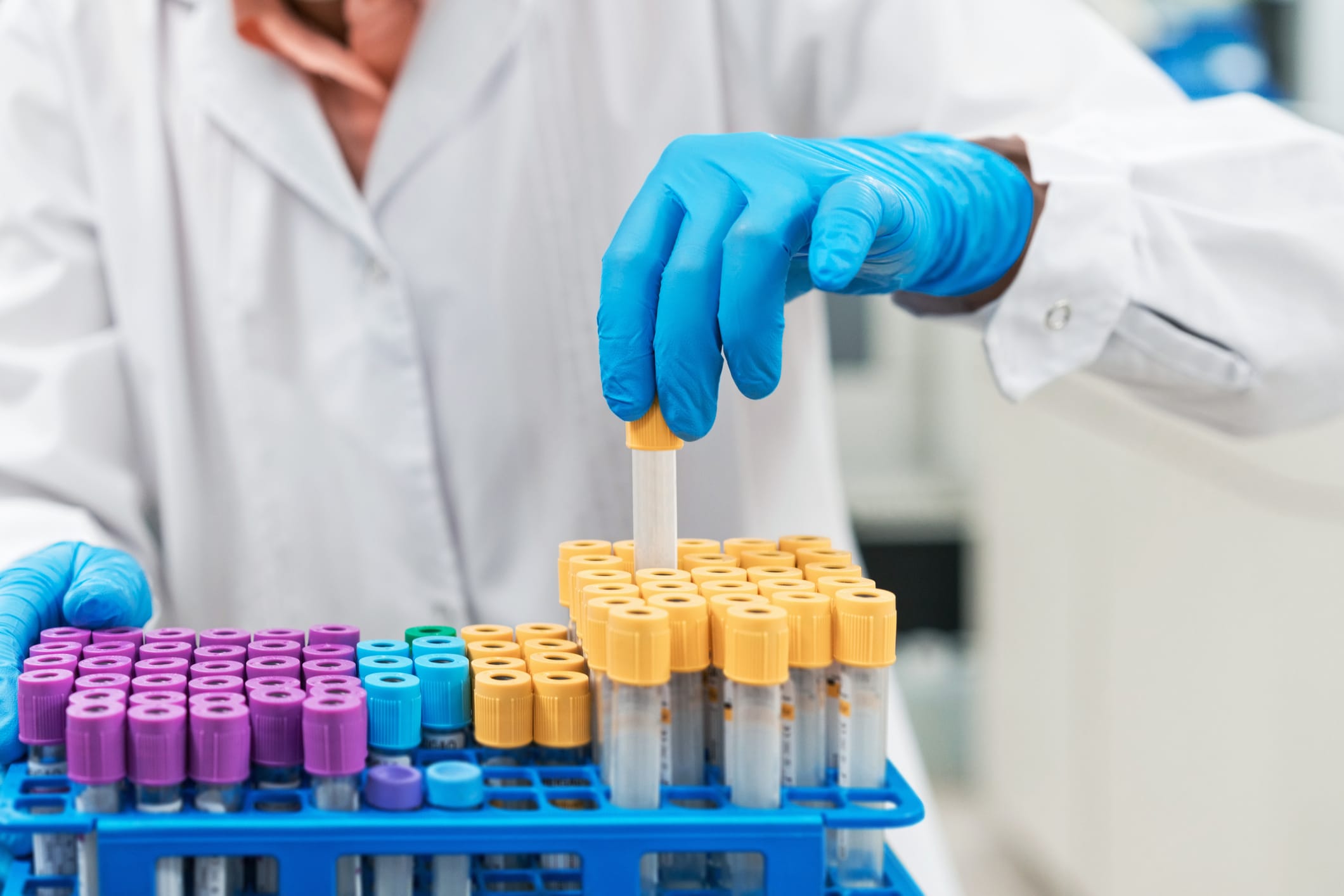 Midsection of female scientist removing medical sample from rack at laboratory