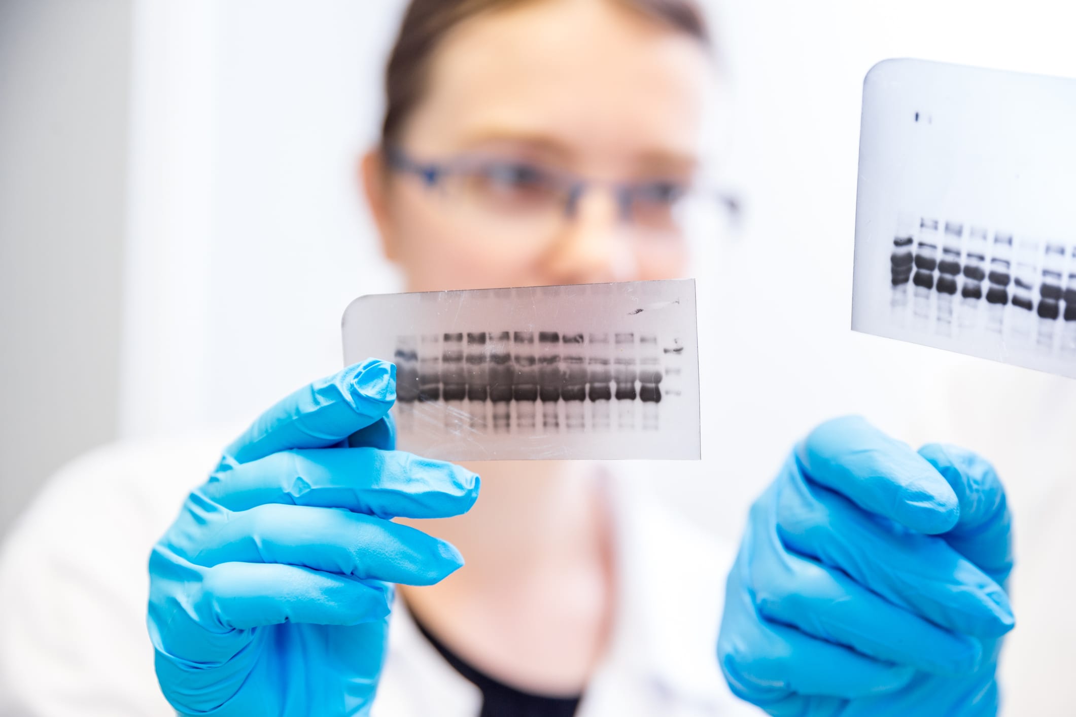 Researcher comparing two electrophoresis samples